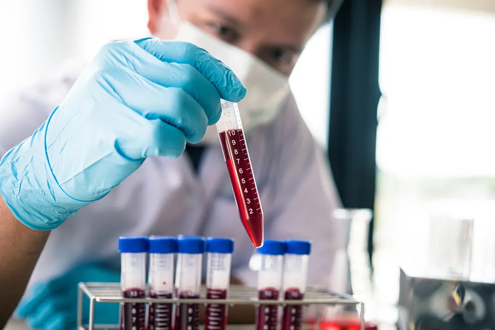 Biospecimen Transportation